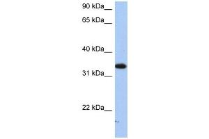 SULT6B1 antibody used at 1 ug/ml to detect target protein. (SULT6B1 antibody  (C-Term))