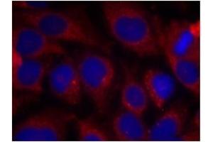 Image no. 2 for anti-SHC (Src Homology 2 Domain Containing) Transforming Protein 1 (SHC1) (Tyr427) antibody (ABIN197591) (SHC1 antibody  (Tyr427))