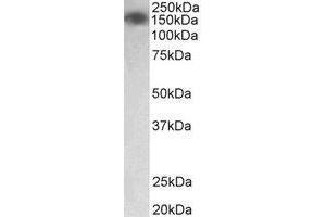 Western Blotting (WB) image for anti-Myosin Light Chain Kinase (MYLK) (Internal Region) antibody (ABIN2465035) (MYLK antibody  (Internal Region))