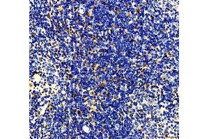 IHC analysis of MTA2 using anti-MTA2 antibody (ABIN7599519). (MTA2 antibody  (AA 1-668))