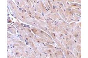 Immunohistochemistry of TRIAD3A in mouse heart with this product at 10 μg/ml.