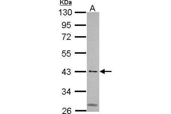 MSL3 antibody  (Center)