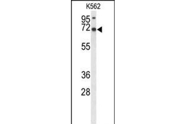 LRRC4 antibody  (C-Term)