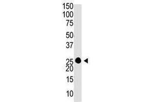 Image no. 2 for anti-Guanylate Cyclase Activator 1A (Retina) (GUCA1A) (C-Term) antibody (ABIN357117) (GCAP1 antibody  (C-Term))