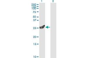 Western Blot analysis of PSMA7 expression in transfected 293T cell line by PSMA7 monoclonal antibody (M01), clone 1A10-3G12. (PSMA7 antibody  (AA 1-248))