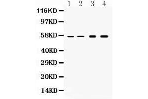 Western blot analysis of Cytokeratin 18 expression in rat liver extract ( Lane 1), mouse liver extract ( Lane 2), HELA whole cell lysates ( Lane 3) and HEPG2 whole cell lysates ( Lane 4).