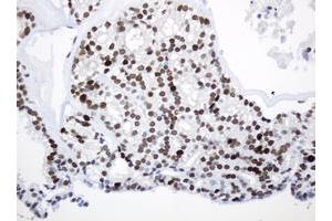 Image no. 2 for anti-Proliferating Cell Nuclear Antigen (PCNA) antibody (ABIN1500061) (PCNA antibody)