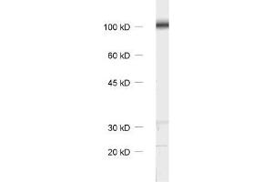 Western Blotting (WB) image for anti-Catenin, beta (CATNB) (AA 768-782) antibody (ABIN1742544)