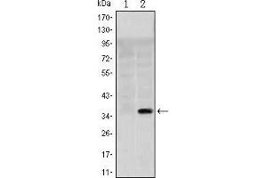 Western blot analysis using SLC22A1 mAb against HEK293 (1) and SLC22A1(AA: 284-347)-hIgGFc transfected HEK293 (2) cell lysate.