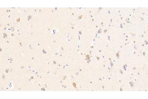 Detection of PURA in Human Cerebellum Tissue using Polyclonal Antibody to Purine Rich Element Binding Protein A (PURA) (PURA antibody  (AA 1-322))