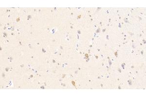 Detection of PURA in Human Cerebellum Tissue using Polyclonal Antibody to Purine Rich Element Binding Protein A (PURA)