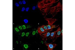 Immunocytochemistry/Immunofluorescence analysis using Mouse Anti-Cav3.