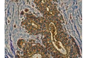 Anti-Rab11a antibody IHC Staining of human mammary tissue, Immunohistochemistry of formalin-fixed, paraffin-embedded tissue after heat-induced antigen retrieval, antibody concentration 1/200,