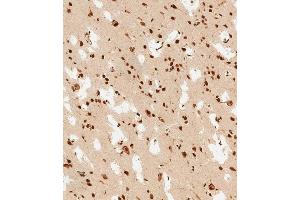 (ABIN6243826 and ABIN6578813) staining PSMD3 in human brain tissue sections by Immunohistochemistry (IHC-P - paraformaldehyde-fixed, paraffin-embedded sections). (PSMD3 antibody  (AA 482-515))