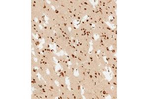 (ABIN6243826 and ABIN6578813) staining PSMD3 in human brain tissue sections by Immunohistochemistry (IHC-P - paraformaldehyde-fixed, paraffin-embedded sections). (PSMD3 antibody  (AA 482-515))