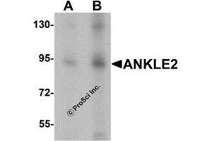 Western Blotting (WB) image for anti-Ankyrin Repeat and LEM Domain Containing 2 (ANKLE2) (Middle Region) antibody (ABIN1030852) (ANKLE2 antibody  (Middle Region))
