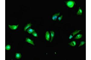 Immunofluorescence (IF) image for anti-Death-Associated Protein Kinase 2 (DAPK2) (AA 222-370) antibody (ABIN7149554)