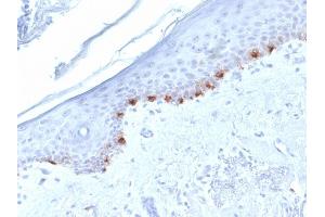 Formalin-fixed, paraffin-embedded human Skin stained with TYRP1-Monospecific Mouse Monoclonal Antibody (TYRP1/1986). (Tyrosinase-Related Protein 1 antibody  (AA 257-377))
