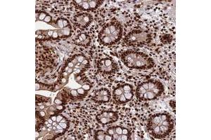 Immunohistochemical staining of human colon with FAM103A1 polyclonal antibody  shows strong nuclear positivity in glandular cells at 1:1000-1:2500 dilution.