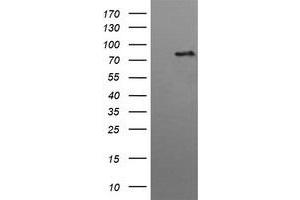 Image no. 2 for anti-Hepatocyte Growth Factor-Regulated tyrosine Kinase Substrate (HGS) antibody (ABIN1498718) (HGS antibody)