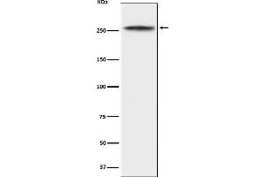 Western blot analysis of CHD3 expression in K562 cell lysate. (Recombinant CHD3 antibody)