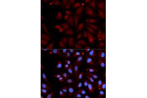 Immunofluorescence analysis of U2OS cells using MAOB antibody. (Monoamine Oxidase B antibody)