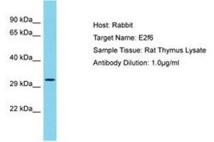 Image no. 1 for anti-E2F Transcription Factor 6 (E2F6) (AA 101-150) antibody (ABIN6750462) (E2F6 antibody  (AA 101-150))