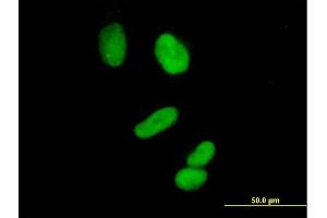 Immunofluorescence of purified MaxPab antibody to CCNH on HeLa cell. (Cyclin H antibody  (AA 1-323))