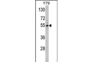 Western blot analysis of Fascin Antibody (Center) (ABIN390697 and ABIN2840983) in Y79 cell line lysates (35 μg/lane). (Fascin antibody  (AA 322-350))