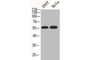 Western Blot analysis of 293T HELA cells using Phospho-Akt1/3 (Y437/434) Polyclonal Antibody (AKT1/3 (pTyr434), (pTyr437) antibody)