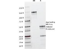 SDS-PAGE Analysis Purified EGFR Mouse Monoclonal Antibody (B1D8). (EGFR antibody)