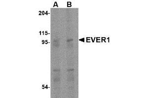 Image no. 1 for anti-Transmembrane Channel-Like 6 (TMC6) (Internal Region) antibody (ABIN1493617) (TMC6 antibody  (Internal Region))