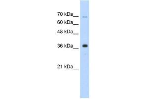 WB Suggested Anti-ZRANB2 Antibody Titration:  0. (ZNF265 antibody  (Middle Region))