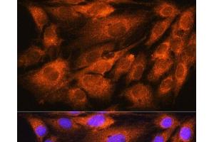 Immunofluorescence analysis of C6 cells using ATP5D Polyclonal Antibody at dilution of 1:100. (ATP5F1D antibody)