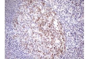 Immunohistochemistry (IHC) image for anti-Achalasia, Adrenocortical Insufficiency, Alacrimia (AAAS) (AA 322-546) antibody (ABIN2715861) (Adracalin antibody  (AA 322-546))