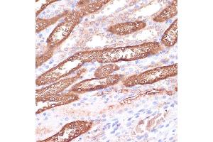 Immunohistochemistry of paraffin-embedded rat kidney using GEMIN5 antibody (ABIN7267367) at dilution of 1:100 (40x lens). (GEMIN5 antibody  (AA 750-950))