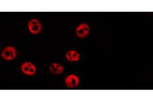 ABIN6274034 staining HepG2 by IF/ICC. (RPS6KA1 antibody  (pSer363, pThr359))