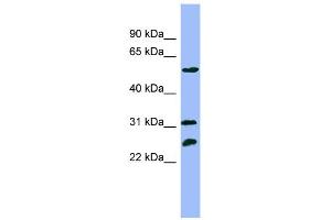 WB Suggested Anti-PSMC4 Antibody Titration: 0. (PSMC4 antibody  (N-Term))