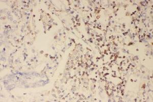 IHC analysis of Profilin 1 using anti-Profilin 1 antibody (ABIN3043603). (PFN1 antibody  (C-Term))