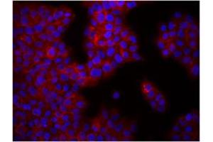 Image no. 1 for anti-Integrin beta 1 (ITGB1) antibody (ABIN205424) (ITGB1 antibody)