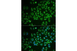 Immunofluorescence analysis of A549 cells using GPLD1 antibody (ABIN5973975).