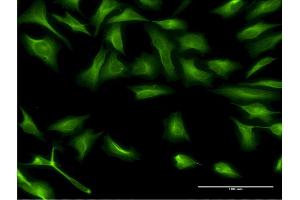 Immunofluorescence of monoclonal antibody to DCP1A on HeLa cell. (DCP1A antibody  (AA 186-285))