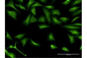 Immunofluorescence of monoclonal antibody to DCP1A on HeLa cell.