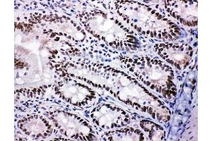 Immunohistochemistry (IHC) image for anti-SHC (Src Homology 2 Domain Containing) Transforming Protein 1 (SHC1) (C-Term) antibody (ABIN3032555)