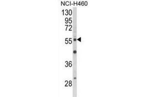 Western Blotting (WB) image for anti-V-Akt Murine Thymoma Viral Oncogene Homolog 2 (AKT2) antibody (ABIN5022918) (AKT2 antibody)