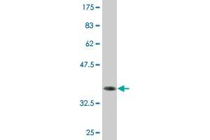 Western Blot detection against Immunogen (36. (ZNF138 antibody  (AA 151-251))