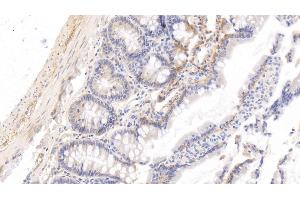 Detection of HRG in Rat Small intestine Tissue using Monoclonal Antibody to Histidine Rich Glycoprotein (HRG) (HRG antibody  (AA 19-525))
