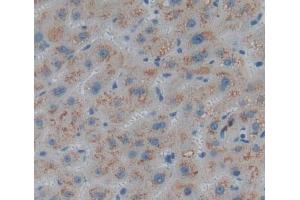 Used in DAB staining on fromalin fixed paraffin- embedded liver tissue (AADAT antibody  (AA 202-425))