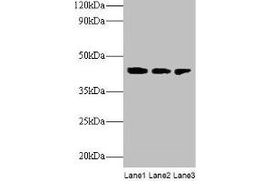 Western blot All lanes: ILKAP antibody at 2 μg/mL Lane 1: Rat kidney tissue Lane 2: U251 whole cell lysate Lane 3: Mouse stomach tissue Secondary Goat polyclonal to rabbit IgG at 1/10000 dilution Predicted band size: 43 kDa Observed band size: 43 kDa (ILKAP antibody  (AA 1-392))