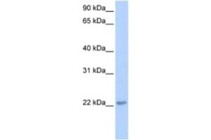 Western Blotting (WB) image for anti-Transcription Elongation Factor A (SII)-Like 2 (TCEAL2) antibody (ABIN2463367)